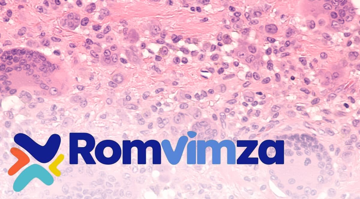 romvimza